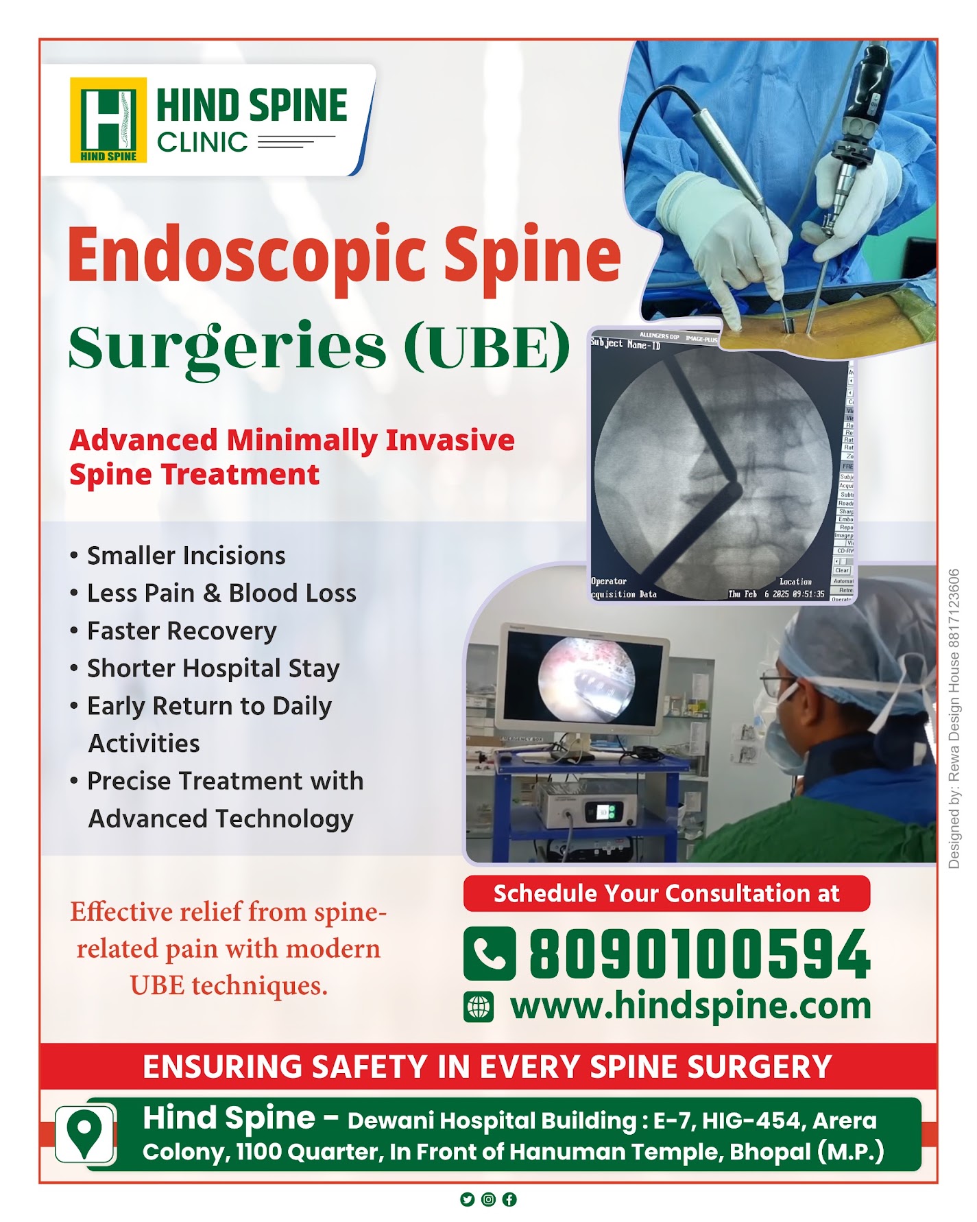 Endoscopic Spine Surgery in Bhopal | Advanced Minimally Invasive Spine Treatment
