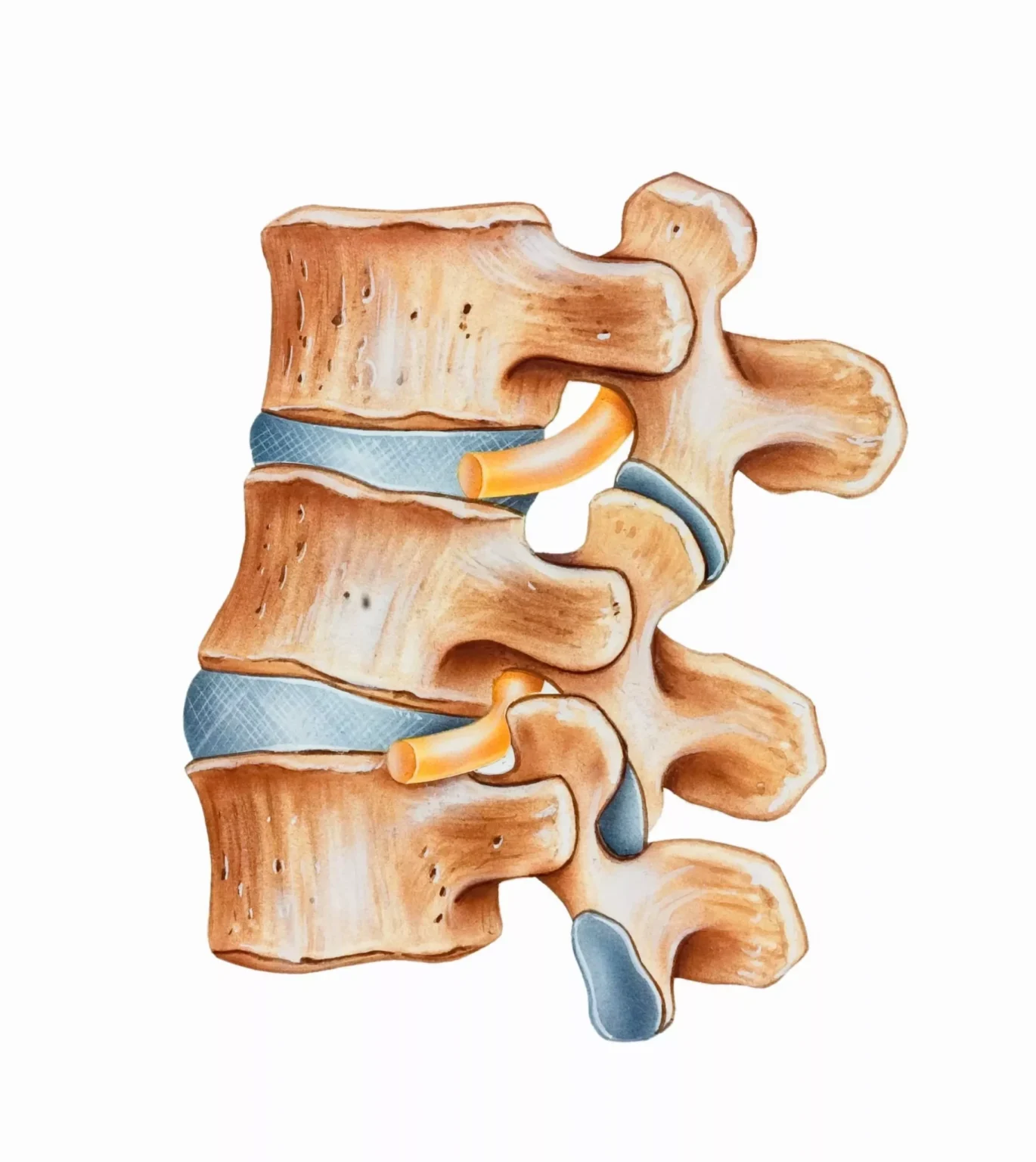 Vertebroplasty & Kyphoplasty